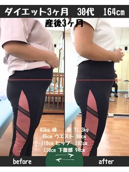 恵整骨院/30代 3ヵ月ダイエット成果
