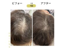 オリエンス(oriens)の雰囲気（純国産、純度100％のエクソソーム液トリプルショットで結果を！）