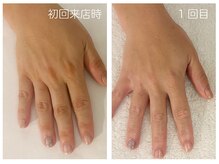 キレイテ 上野店/40代/1回目【ハンドケア上野】
