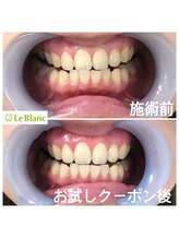 ルブラン 奈良店(Le Blanc)/初めての方でも！