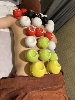 熙金 九龍SPA/カッピング(吸い玉)