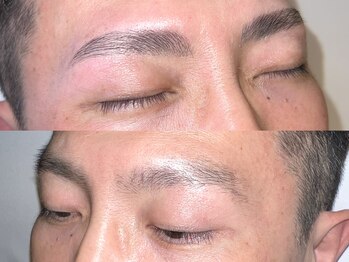 キャンバス 初台(CANVAS)/- Men's HBL - Before/After