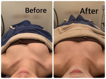 ジェイオー(J.O)/バストアップコルギ/小顔コルギ