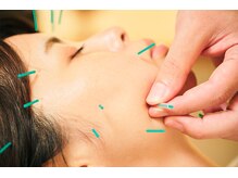 とまり木鍼灸整骨院/