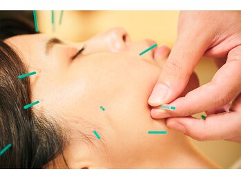 とまり木鍼灸整骨院/優しい刺激の美容鍼