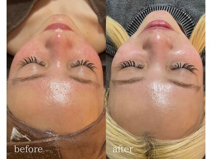 ミナアズアシリ(MINA as asir)の写真