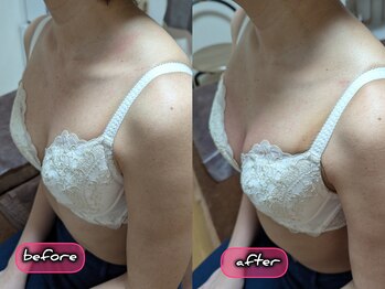 スノードロップ(snowdrop)/バストアップ　１回での変化