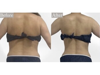 プリマルーチェ/プレミアム上半身プログラム