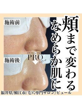 ピュール 鯖江店(PUR)/毛穴サロン/毛穴ケア/毛穴洗浄