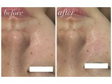 ビアス(Biasu)/肌育造顔フェイシャル