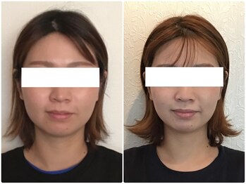 ウェリナ平和堂長久手院/小顔矯正/骨盤矯正/美脚サロン