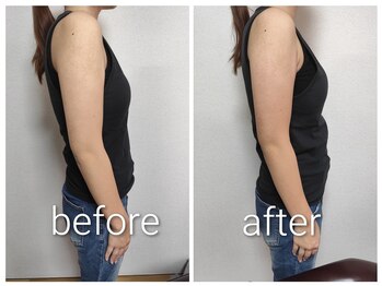 ビューティーエー(Beauty I)/痩身