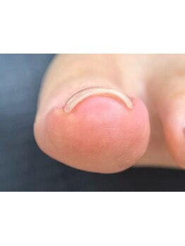 爪の悩みを解消できる（ケア含む）