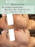 【シミ・くすみケア】透明感UP!光フェイシャル¥9980