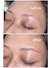 ワフトヒルズ 津田沼店(Waft Hills)/ハリウッドブロウリフト