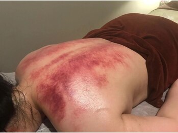 迷森(メーモリ)/施術1