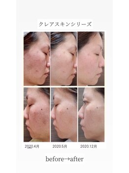 プリヴィエレジェ(privilegie)/