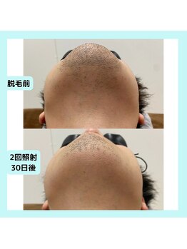 アリア 新小岩(Aria)/☆効果☆