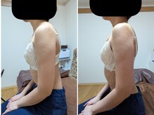 スノードロップ(snowdrop)/バストアップ　１回での変化