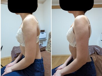 スノードロップ(snowdrop)/バストアップ　１回での変化