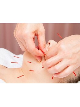 鍼灸施術を受けたい