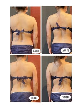 パールプラス(Pearl+)/痩身エステ＋ボディメイク