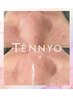 【黒ずみ毛穴速攻クリアに♪】毛穴洗浄+ビタミンCイオン導入！9900円→6600円
