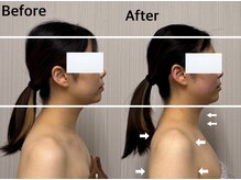 ベール(BEHL)/コルギのBefore After