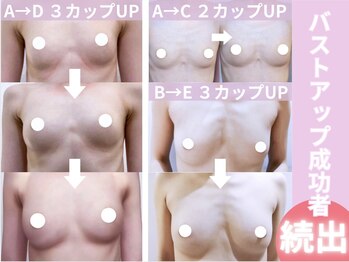 キアナ 横浜店(Kiana)/平均2～3カップUP続出