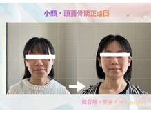 メリー 大和西大寺店(merry)/小顔・頭蓋骨矯正Before after★