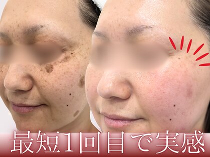 ハウオリ(HAUOLI)の写真