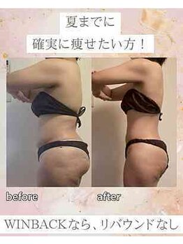 エソール(essor)の写真/４0代でも大幅減量を目指す！最新痩身機器で一気にダイエットしたい方◎最強痩身WINBACK×神業ハンド
