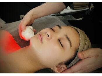 ノア(NOA.)の写真/【IPL光フェイシャルエステで結果重視のたるみ改善!ほうれい線が気になる方/小顔になりたい方にオススメ】