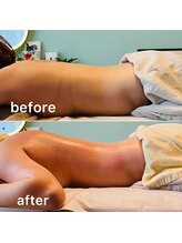 キノ(Kino)/セルライトゼロ★