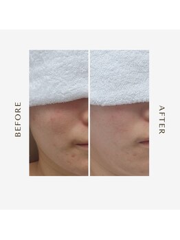 オーシャン(OCEAN)/before after