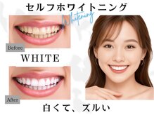 ホワイトニングサロン ホワイト 天童店(WHITE)