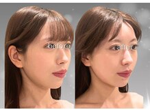 ソナ 大和西大寺院(SONA)/