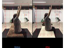 ストレチックス 近江八幡店/姿勢改善ビフォーアフター1回