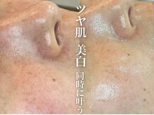 ココリールの雰囲気（ピーリング×光フェイシャルで土台を整える。施術内容はブログへ）