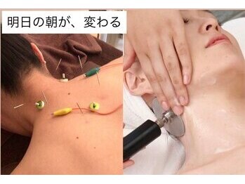 フィットジユウガオカ(Fit_Jiyugaoka)の写真/【30～50代支持】首肩こり改善★国家資格保有者対応★鍼＆インディバの相乗効果★