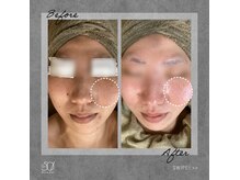 ゴーマルイチ(501)の雰囲気（【IPL光フェイシャル】お肌の土台を整え、ノーファンデ肌へ◎）