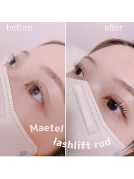 タスカ(Tasca)/メーテルロッド