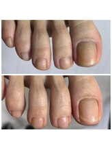 ドクターネイル爪革命 十条店/爪ケア