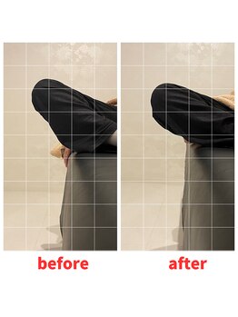 ナオル整体 福岡香椎院(NAORU整体)/40代女性施術事例【可動域制限】