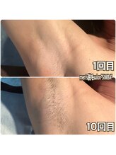 シンバ 倉敷店(SIMBA)/