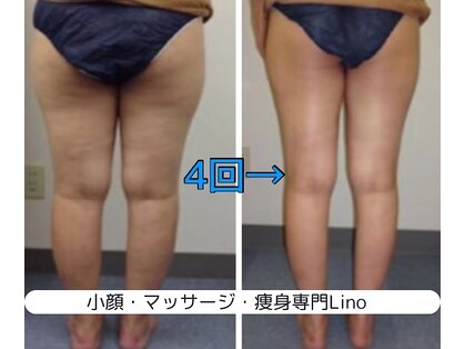 リノ(Lino)の写真