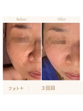 ガムラン(Gamelan)/フォト＋（3回目）