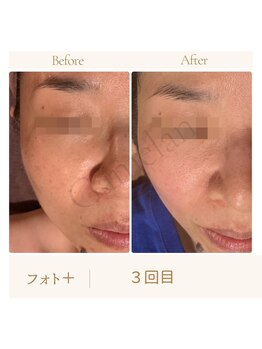 ガムラン(Gamelan)/フォト＋（3回目）