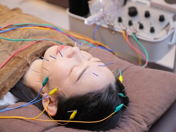 ニコディア(nico-dia)の写真/美容鍼×微弱電流で理想の美顔に♪たるみ・ほうれい線・小じわを改善！リフトアップ効果もあり☆