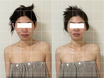 ステムサロン(stem salon)/ビフォーアフター